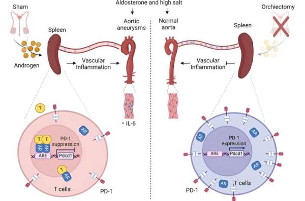 Understanding sex-specific differences in aortic aneurysms